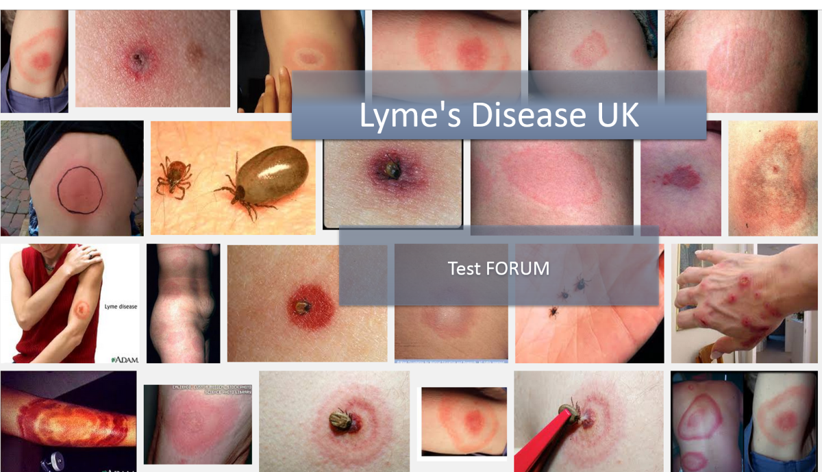 lyme disease lyme disease