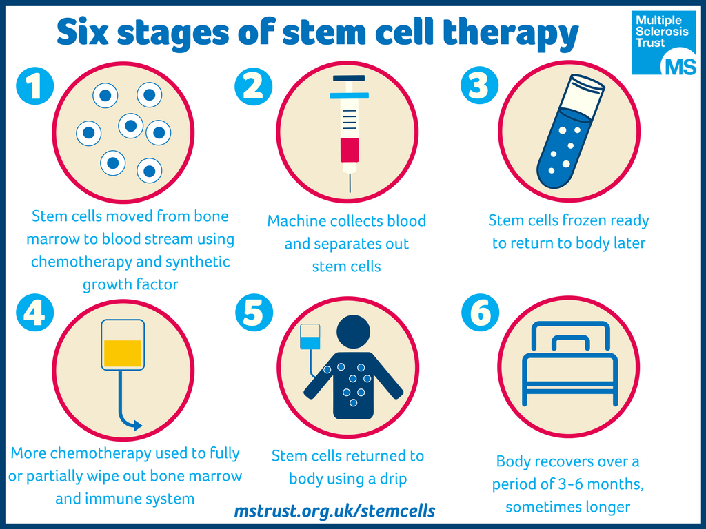 stem cell therapy