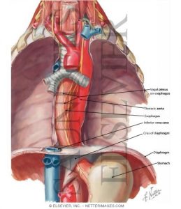 Heartburn,Gastric Reflux,Esophageal Spasms,And Hiatal Hernia:Caused By ...